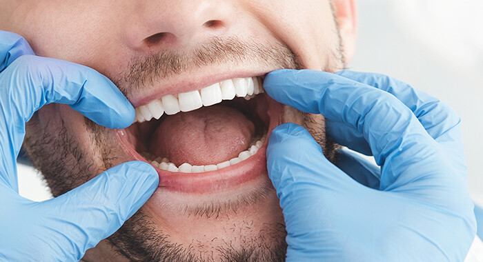 Ästhetische Zähne